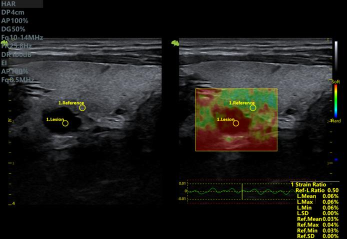 Máy siêu âm 5D Vinno S100